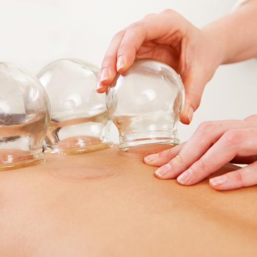 Cupping-coast-rehab-millstone-manasquan-toms-river-nj