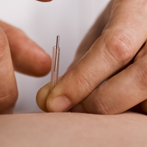 acupuncture-coast-rehab-millstone-manasquan-toms-river-nj